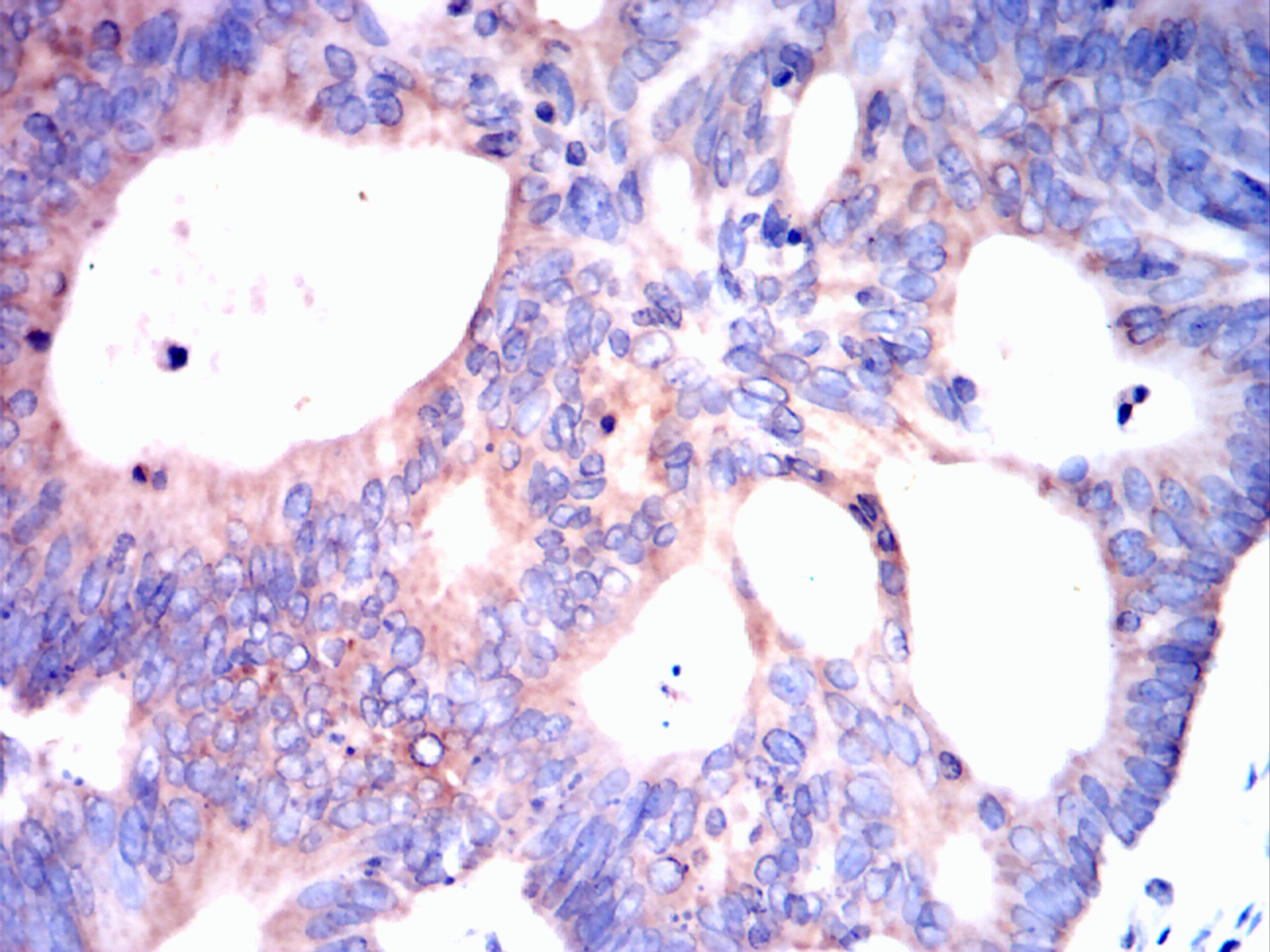                  IHC